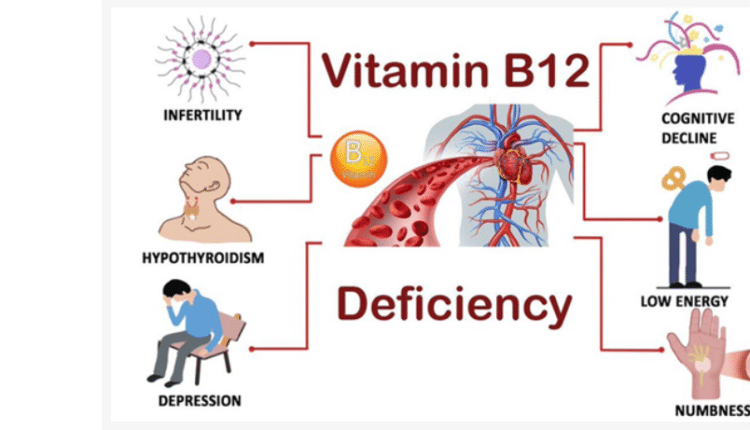 B12 deficiency